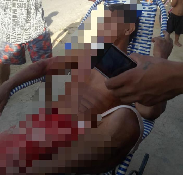 Homem é alvejado com um tiro de espingarda, em Parintins; o autor do disparo foi preso