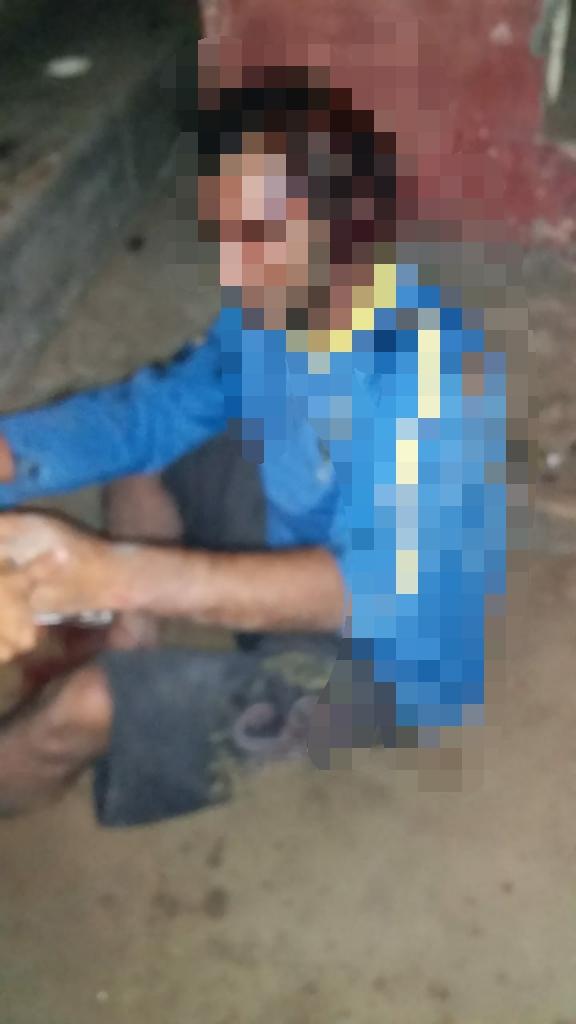 Em Parintins, Homem é cacetado por três elementos no Bairro União