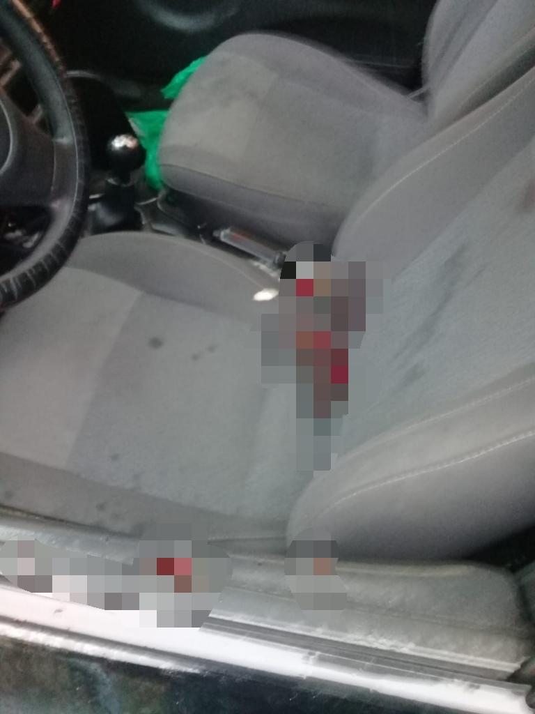 Homem sofre tentativa de homicídio, em Parintins; a vítima foi atingida com 4 disparos de arma de fogo
