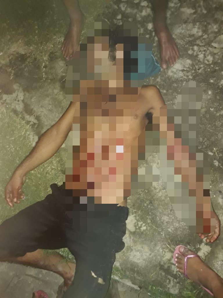 Homem é esfaqueado no Bairro União, em Parintins