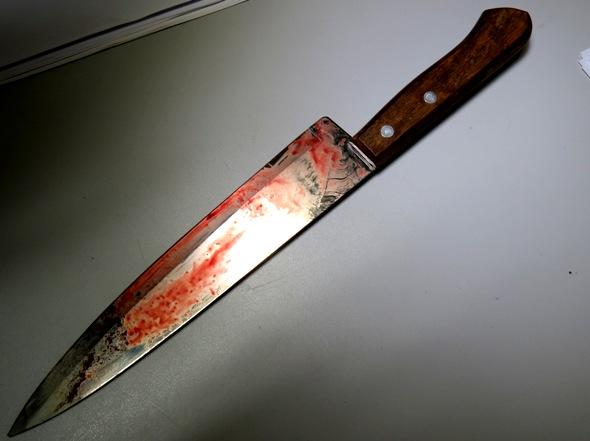 Após descobrir que filha foi abusada, mulher corta pênis do marido