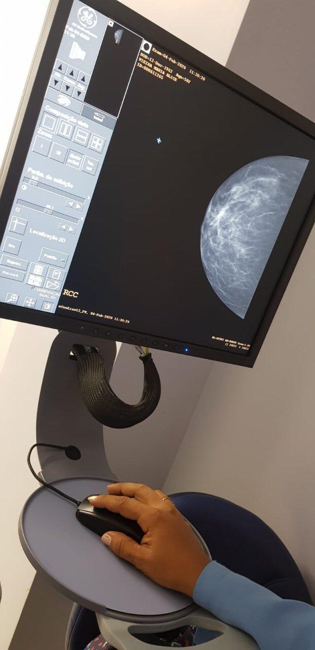 Sem filas de espera na capital, oferta de mamografia na rede pública do Amazonas cresceu 10% em 2019