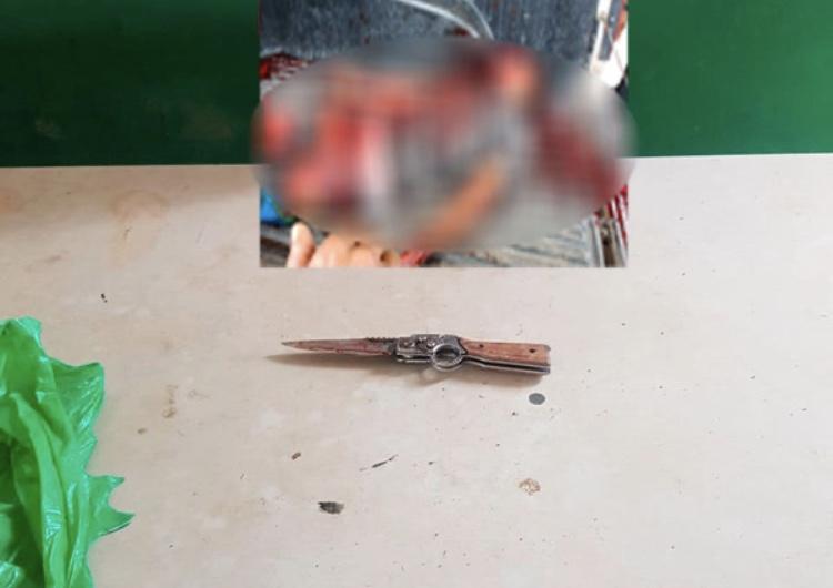 Homem mata colega de trabalho com perfuração no pescoço, em Maués 