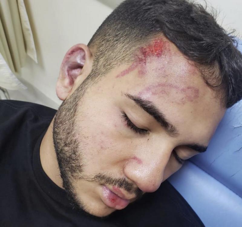 estudante é espancado por quarteto na Banda do Vieiralves