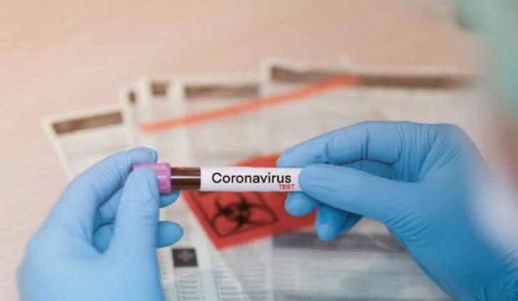 Brasil registra 105 mil casos e 7,2 mil mortes por novo coronavírus