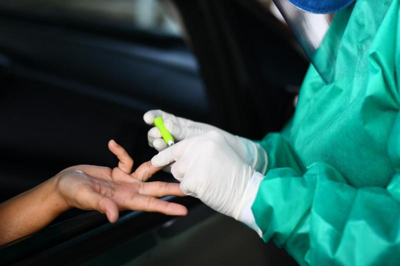 Amazonas chega a 12.919 casos confirmados de Covid-19; óbitos sobem para 1.035