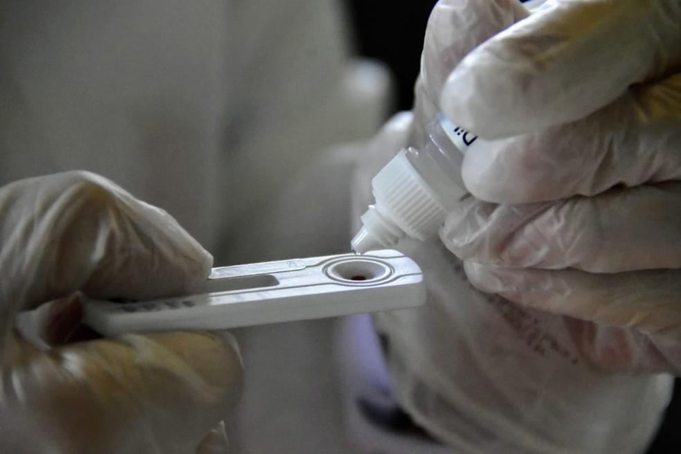 Santarém ultrapassa a marca dos 3 mil infectados por Covid-19; número de mortos chega a 178 Santarém ultrapassa a marca dos 3 mil infectados por Covid-19; número de mortos chega a 178