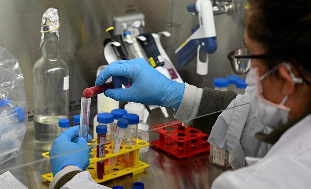 Pará confirma mais 1.987 casos de Covid-19; estado acumula 120.731 infectados e 5.196 óbitos Pará confirma mais 1.987 casos de Covid-19; estado acumula 120.731 infectados e 5.196 óbitos