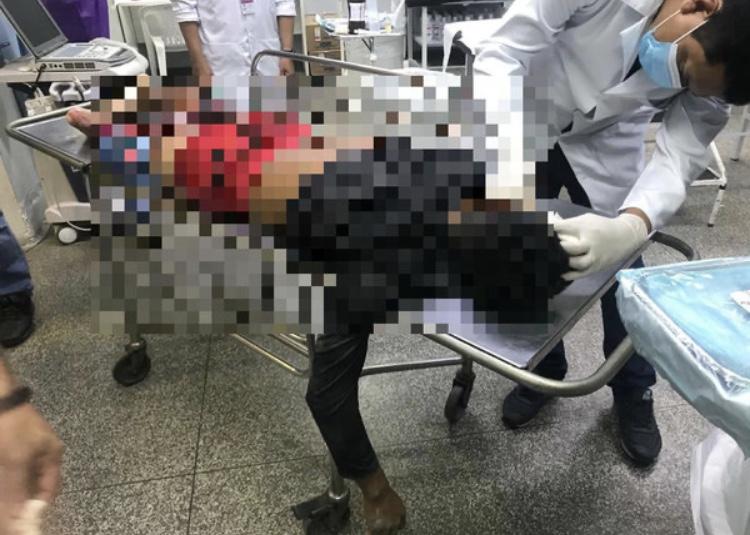 Homem morre em confronto com a Rocam no Jorge Teixeira, em Manaus