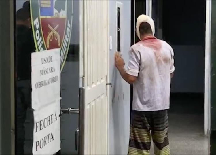 Suspeito de assalto perde os dentes ao ser agredido por população em Manaus