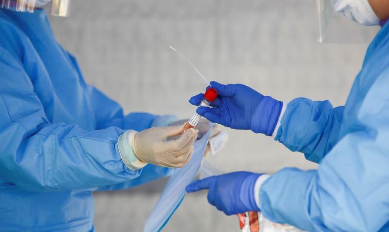 Ministério da Saúde confirma primeiro caso de reinfecção por covid-19 no país