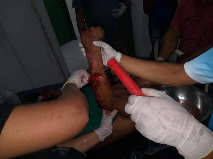 Policiais Militares prendem homem por tentativa de homicídio na Área Indígena do Molongotuba, em Barreirinha 