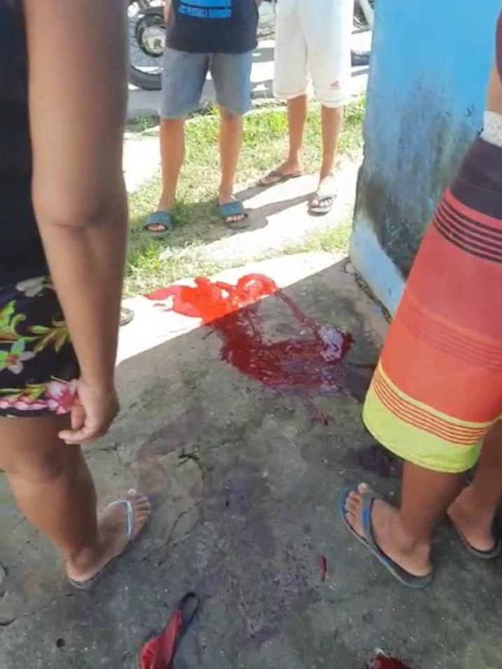 Homem sofre tentativa de homicídio, em Parintins 