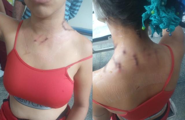 Mulher é atacada com facadas pelo marido, em Coari