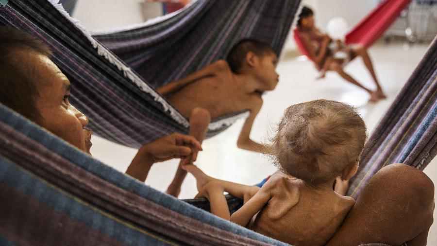 Fora do radar Federal, Yanomami do AM sofrem com desnutrição e malária
